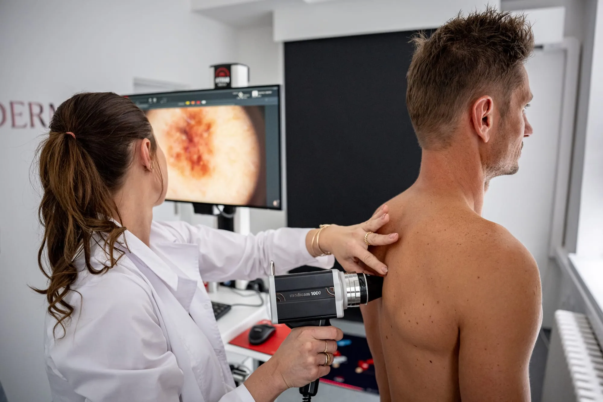 Lékařka vyšetřuje znaménka na zádech pacienta kamerou FotoFinderu